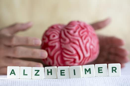 How Alzheimer's Affects the Brain's Memory Systems in Tucson, AZ