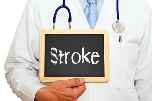 Measuring the Severity of a Stroke in Tucson, AZ